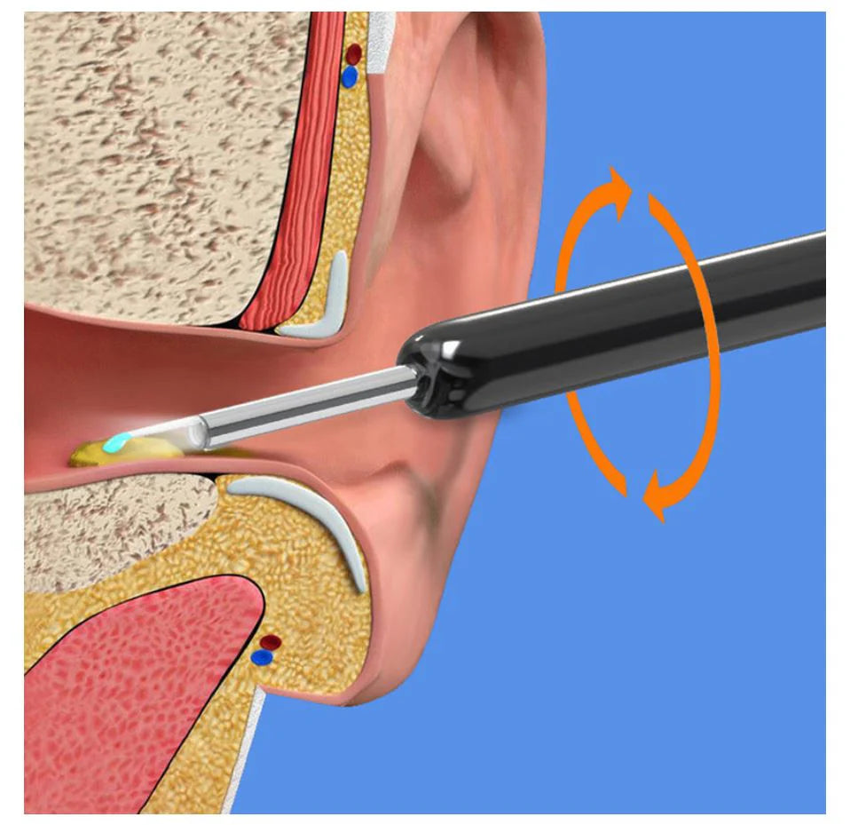 Ear Wax Removal Kit with Camera and Light